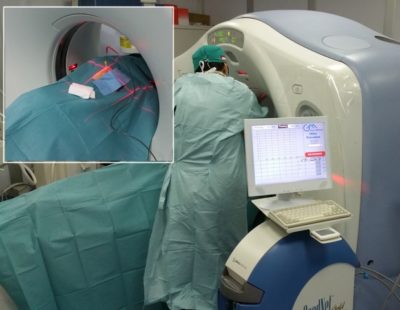 Medicina / Tumori vertebrali distrutti mediante congelamento: la “crioablazione” introdotta all’ospedale Cannizzaro