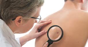 Sanità / Prevenzione tumori della pelle: ad Acicastello screening gratuiti