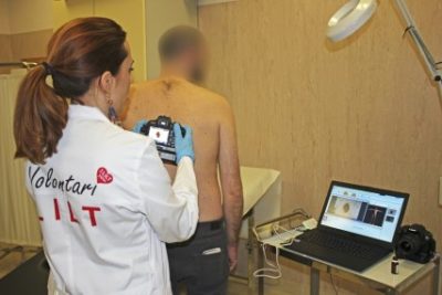 LILT / A Catania-Nesima un dermatoscopio di ultima generazione per la mappatura dei nei nella prevenzione del melanoma