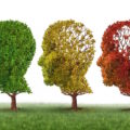 alzheimer