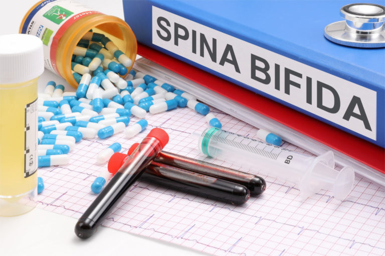 Spina bifida