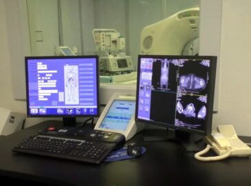 ospedale Cannizzaro,screening polmonare