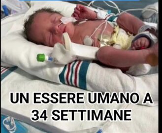 Un essere umano a-34 settimane